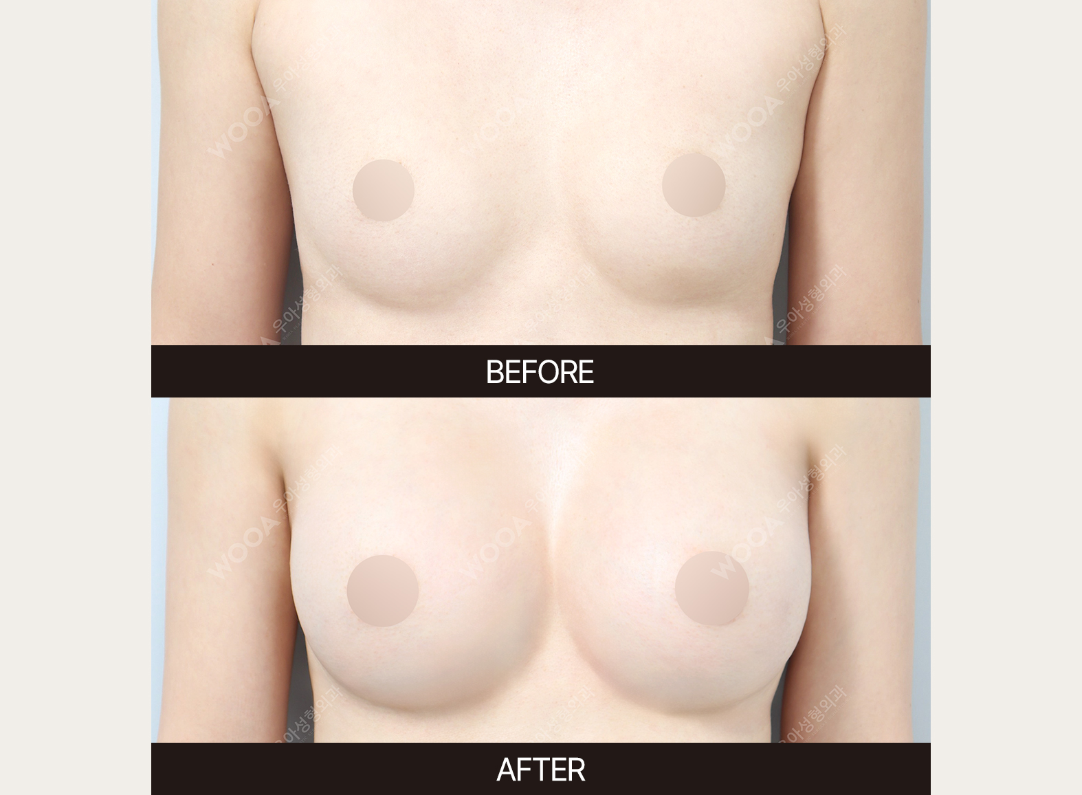 김우정박사 4-1.jpg