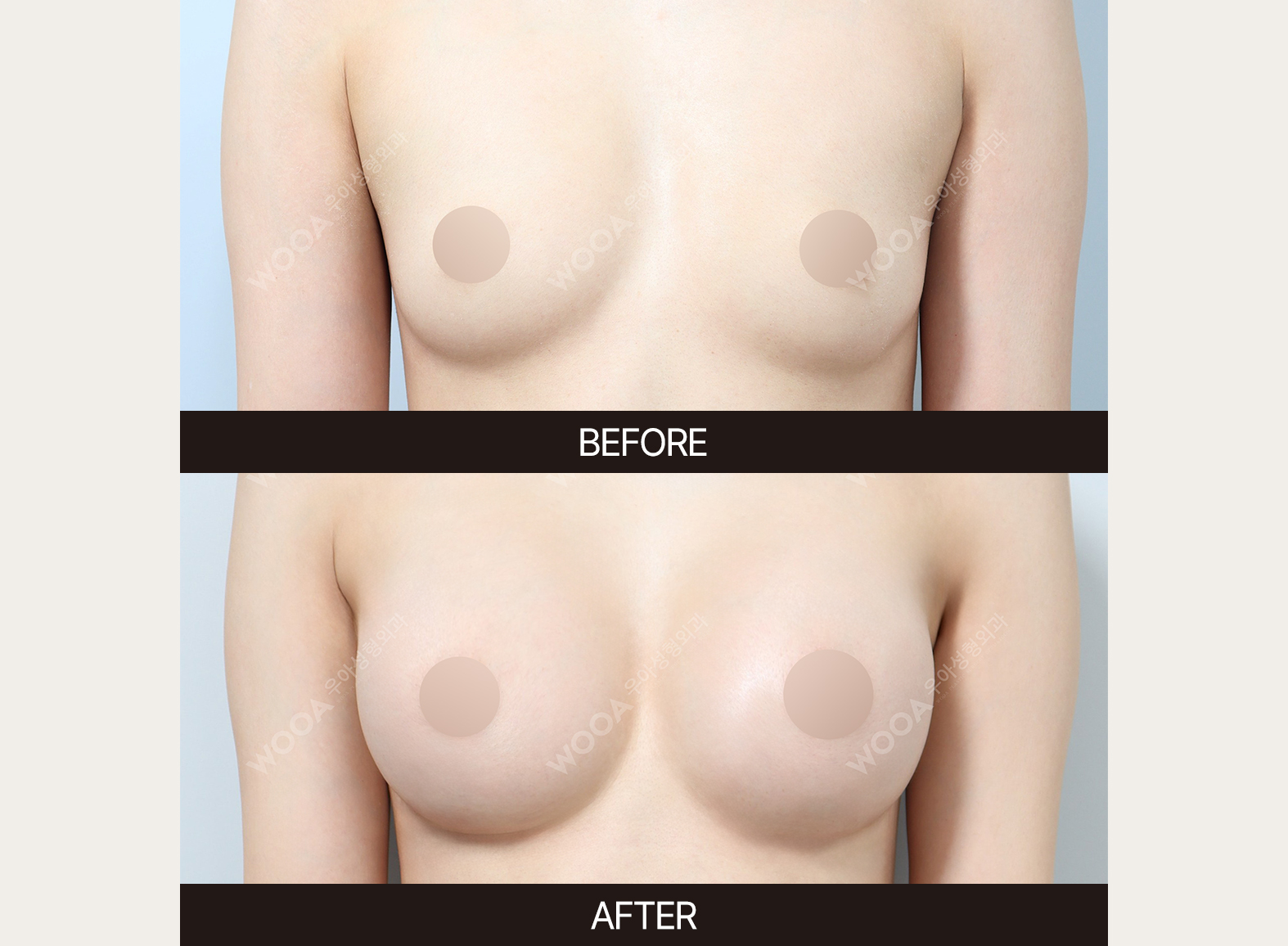 김우정박사 5-1.jpg