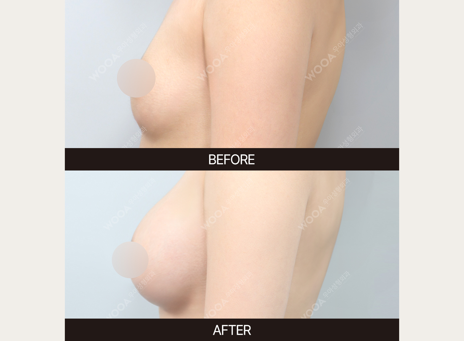 김우정박사 3-2.jpg