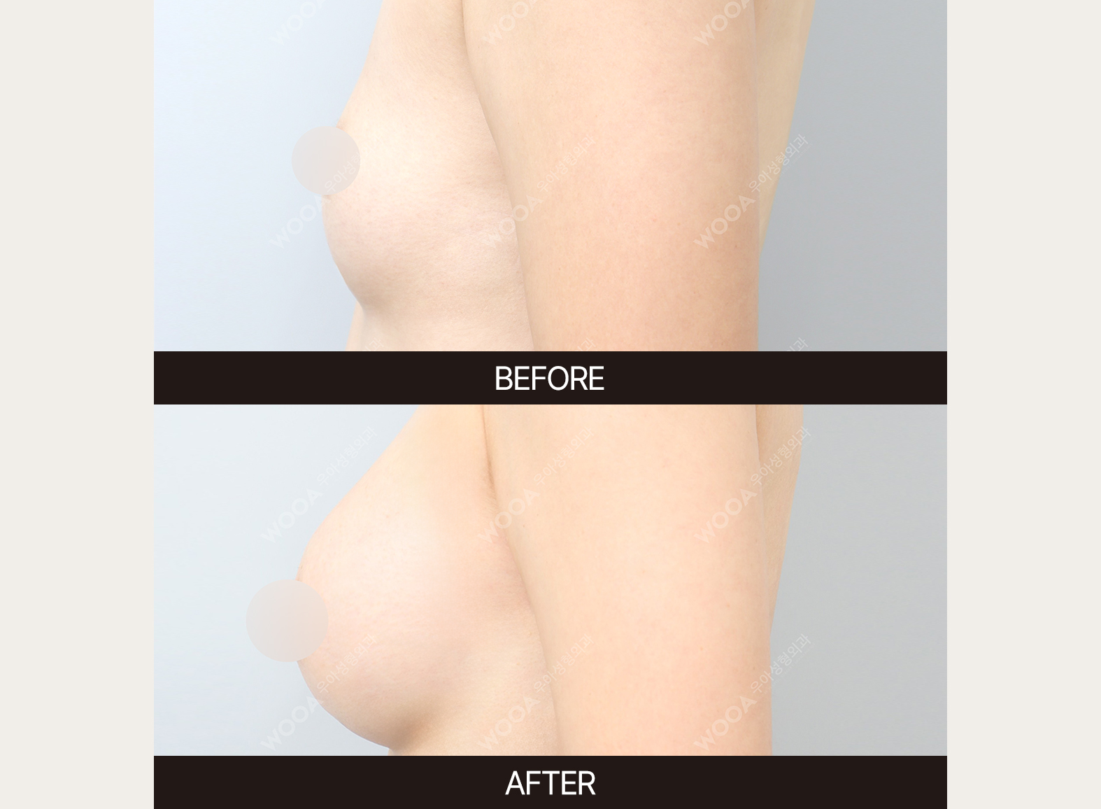 김우정박사 4-2.jpg