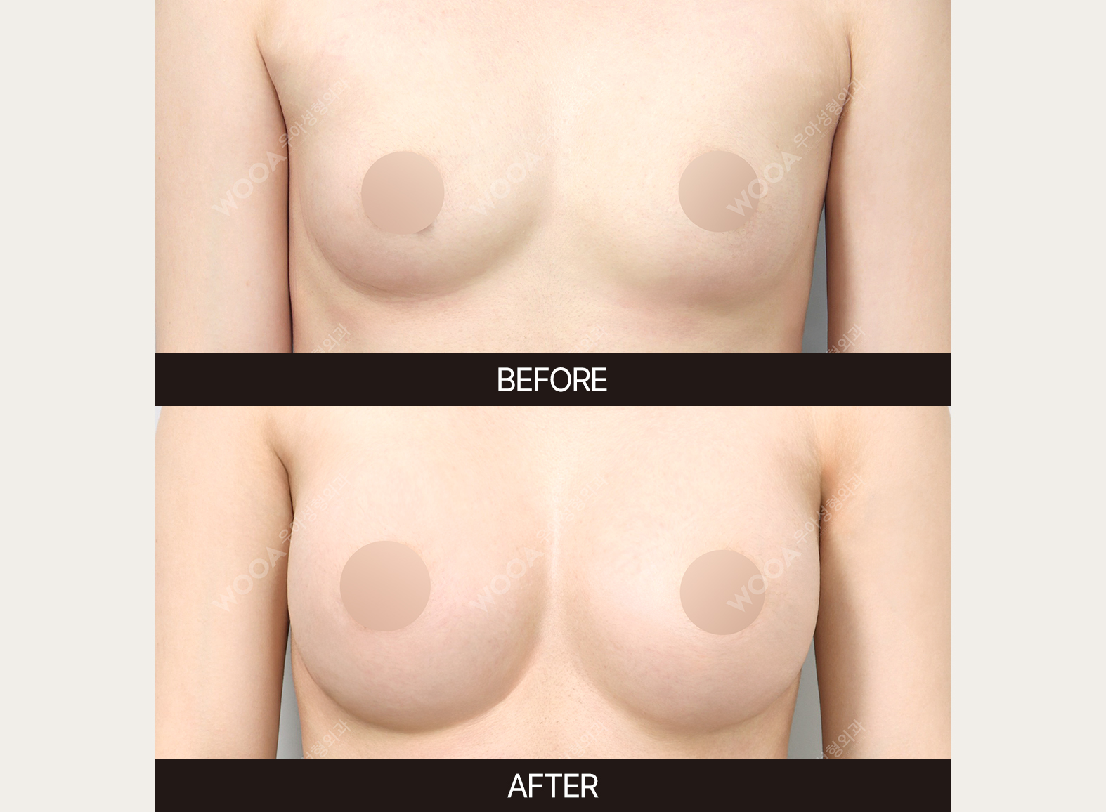 김우정박사 3-1.jpg