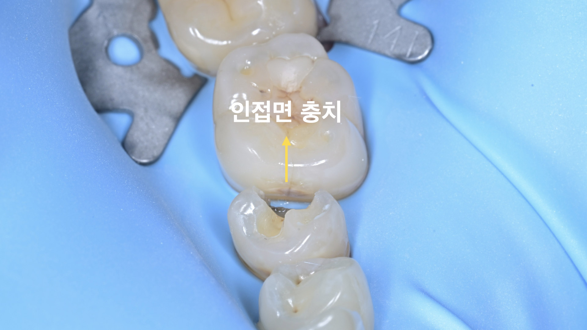 1acdfa015d70f.png