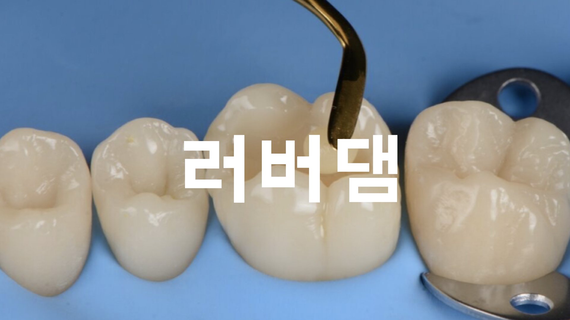 6121af43a5548.png