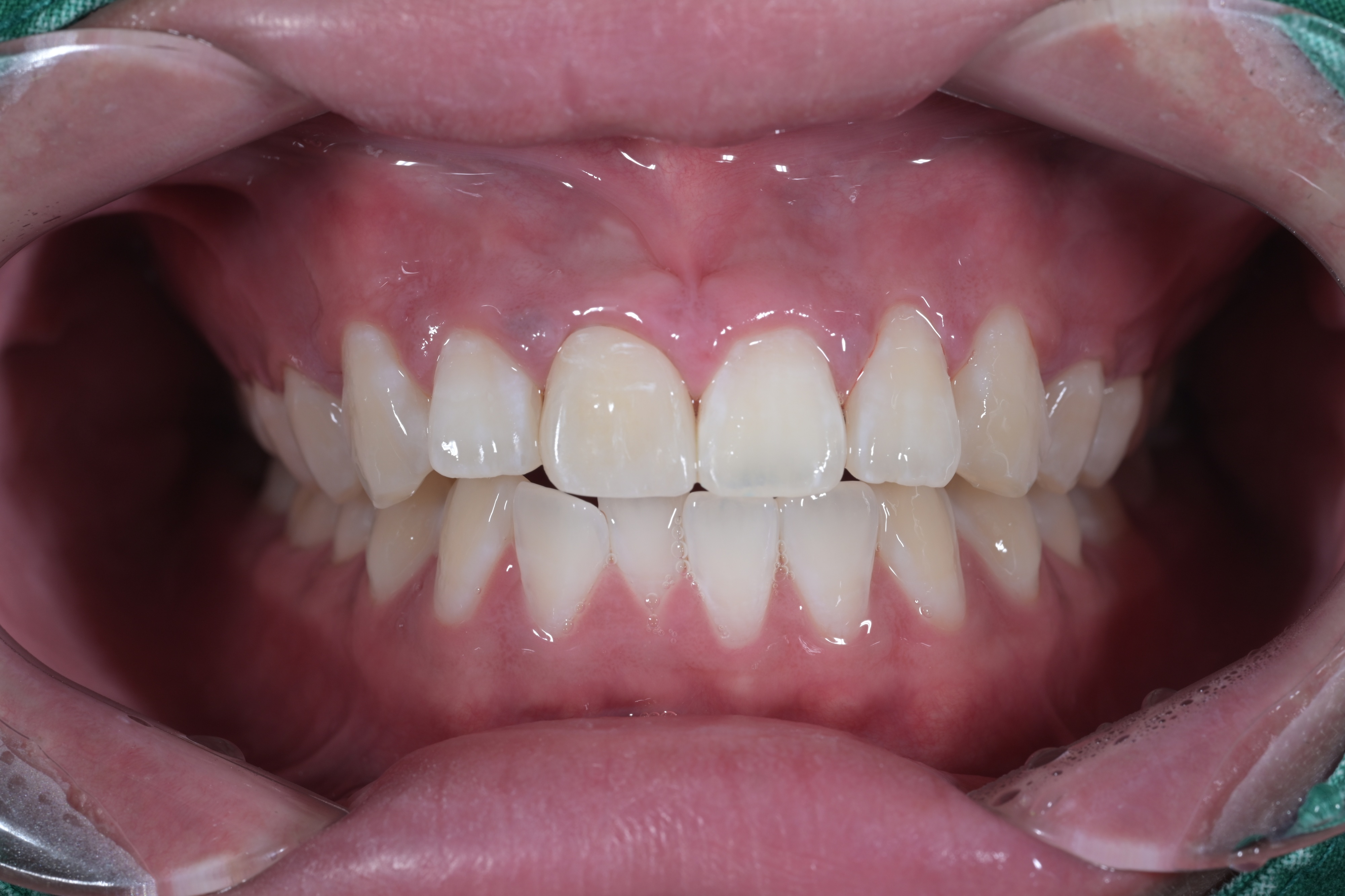 680c7bd0e76cd.jpg
