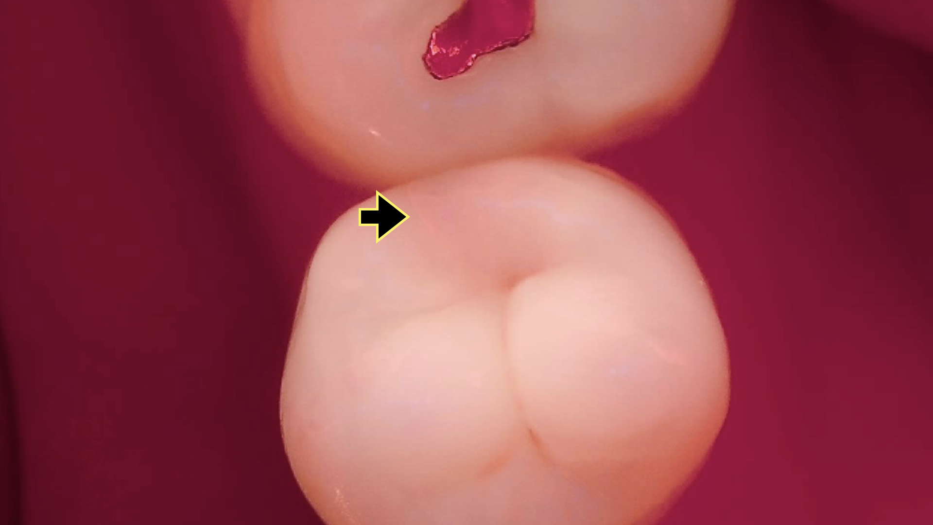 8f887a6b560d0.png