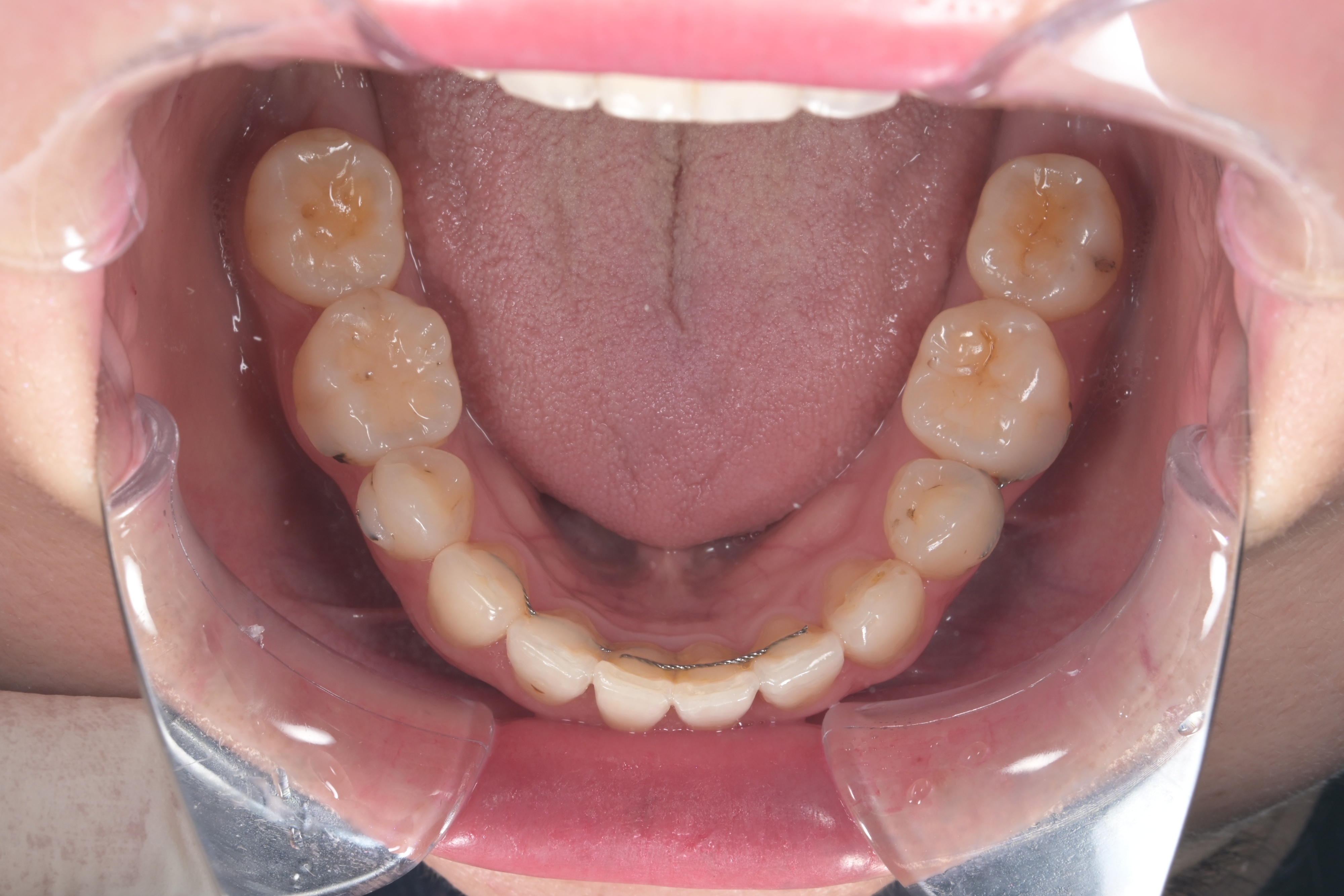 96740bb20f8e4.jpg
