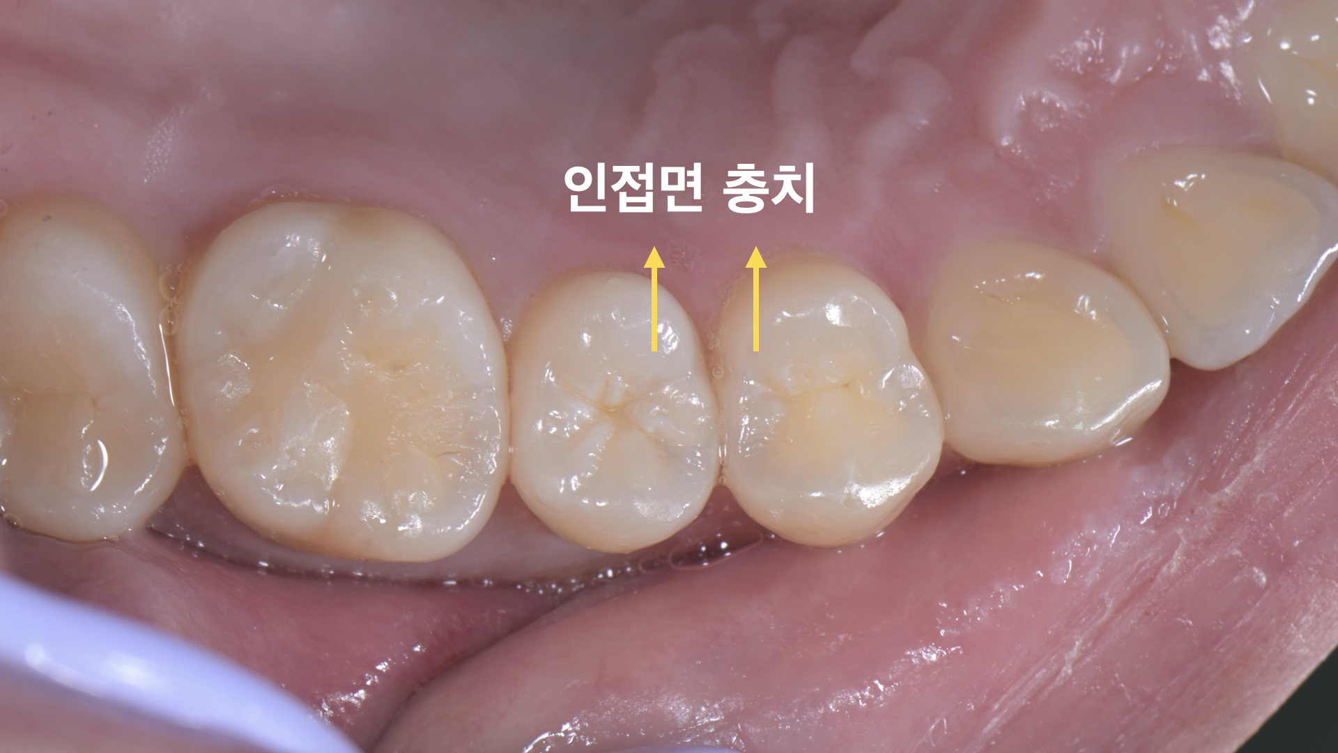 b19065e639bb5.png