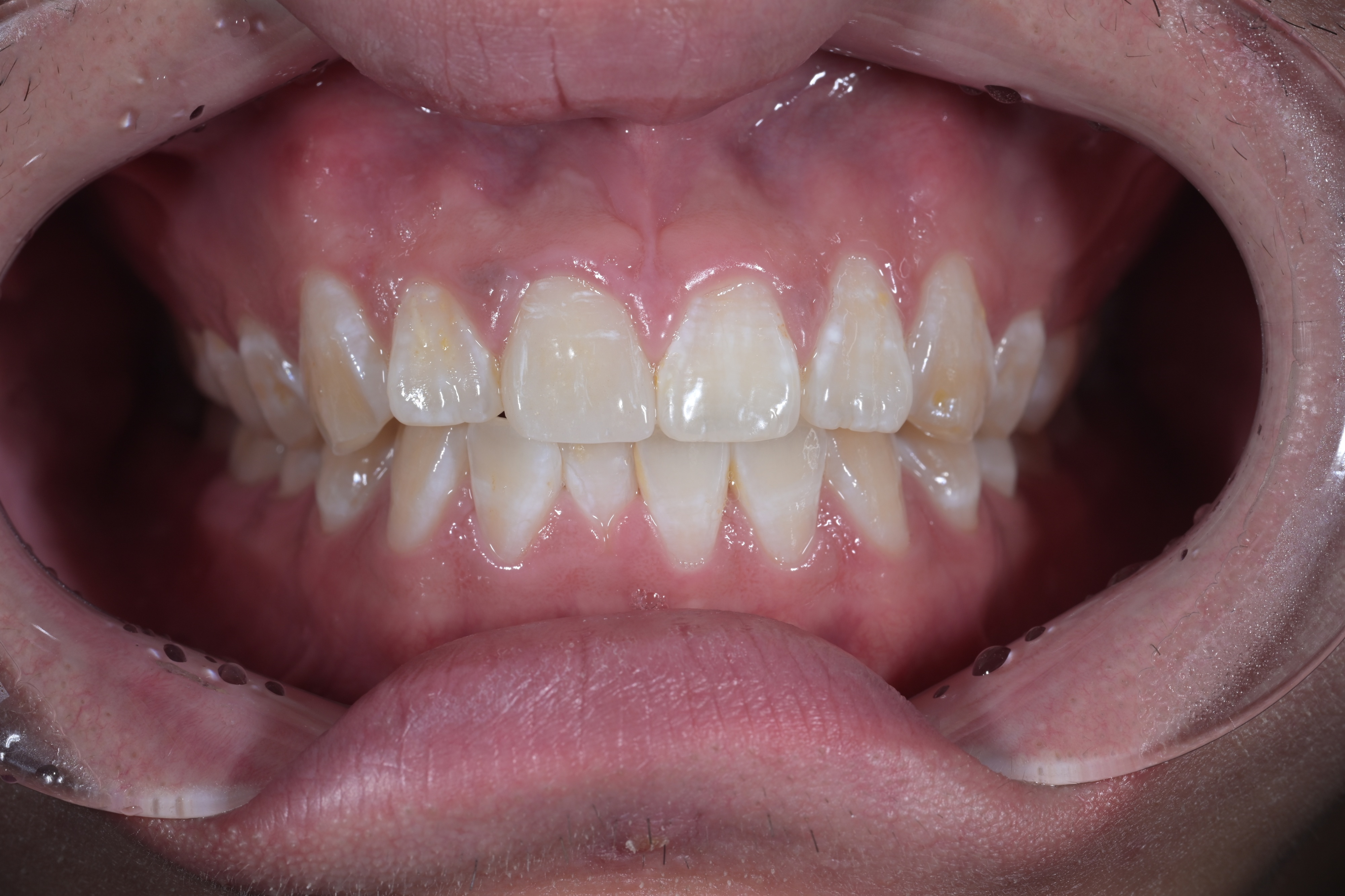 d3d7f6d532d83.jpg
