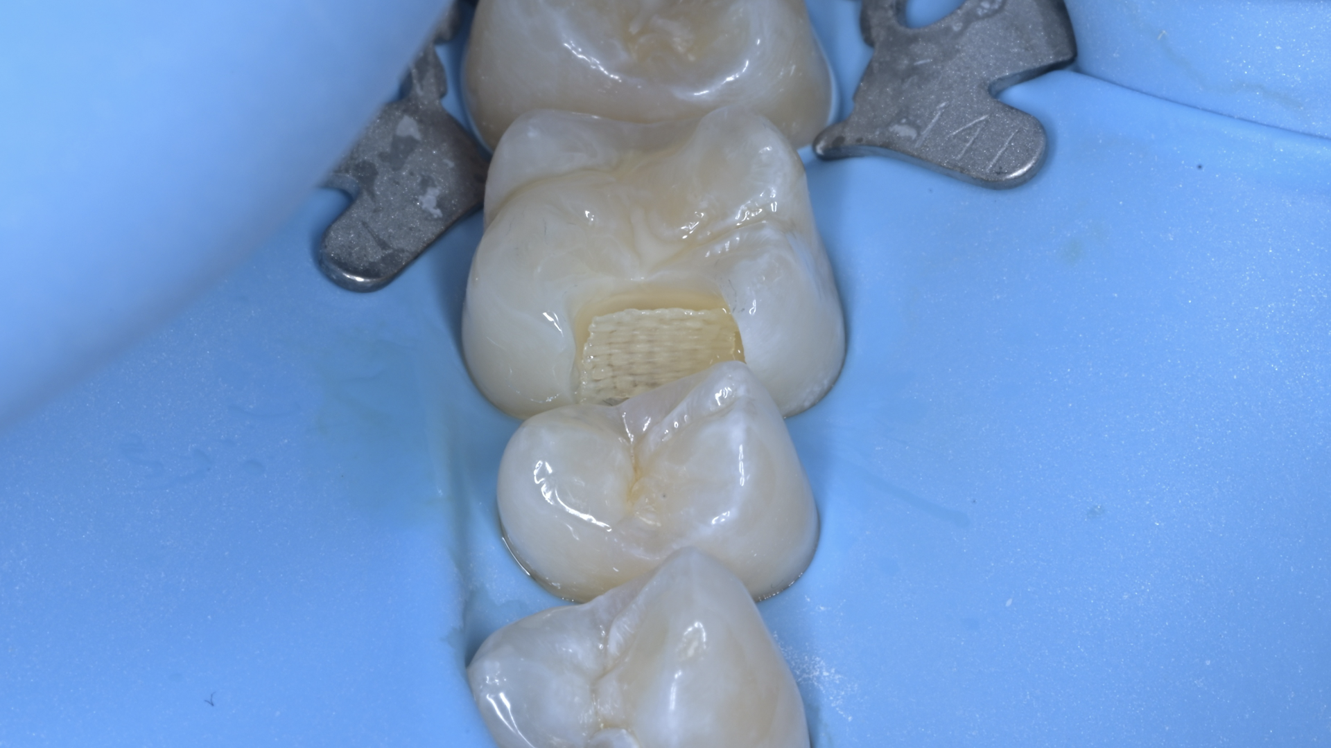 efd479924e6d8.png