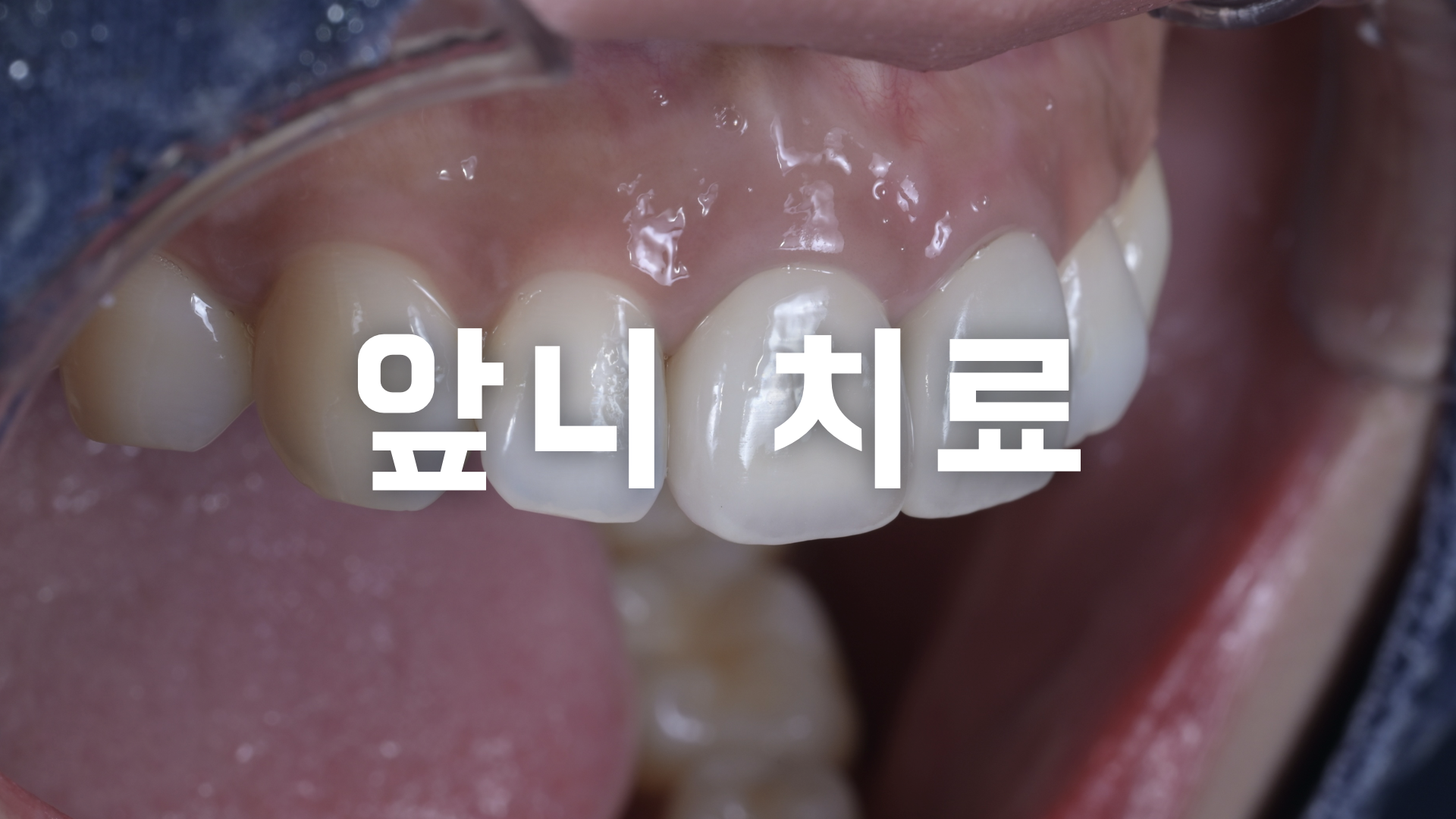 f899829db468f.png