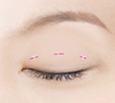 Step 3