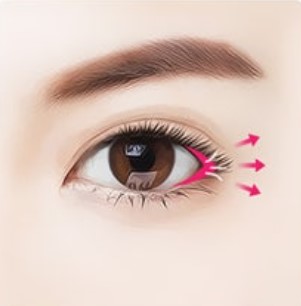 STEP 03