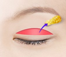 Step 4