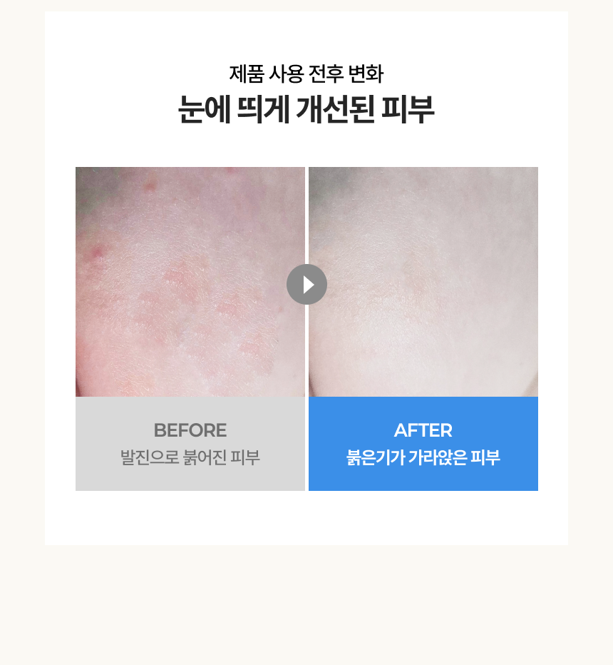 루베어 R1 | 03 Airy Embrace Cream (에어리 임브레이스 크림) | 민감성 피부 기저귀 생리대 발진 크림