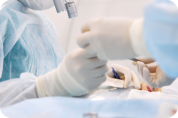 유리체 절제술 이미지