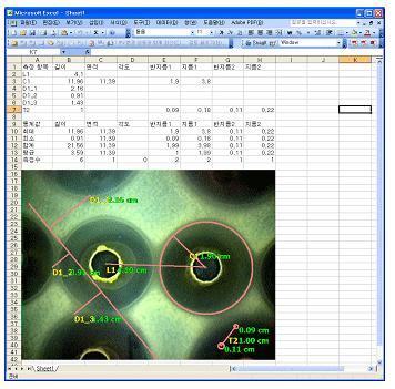 I-MEASURE PLUS Automated Measurement Report Generation
