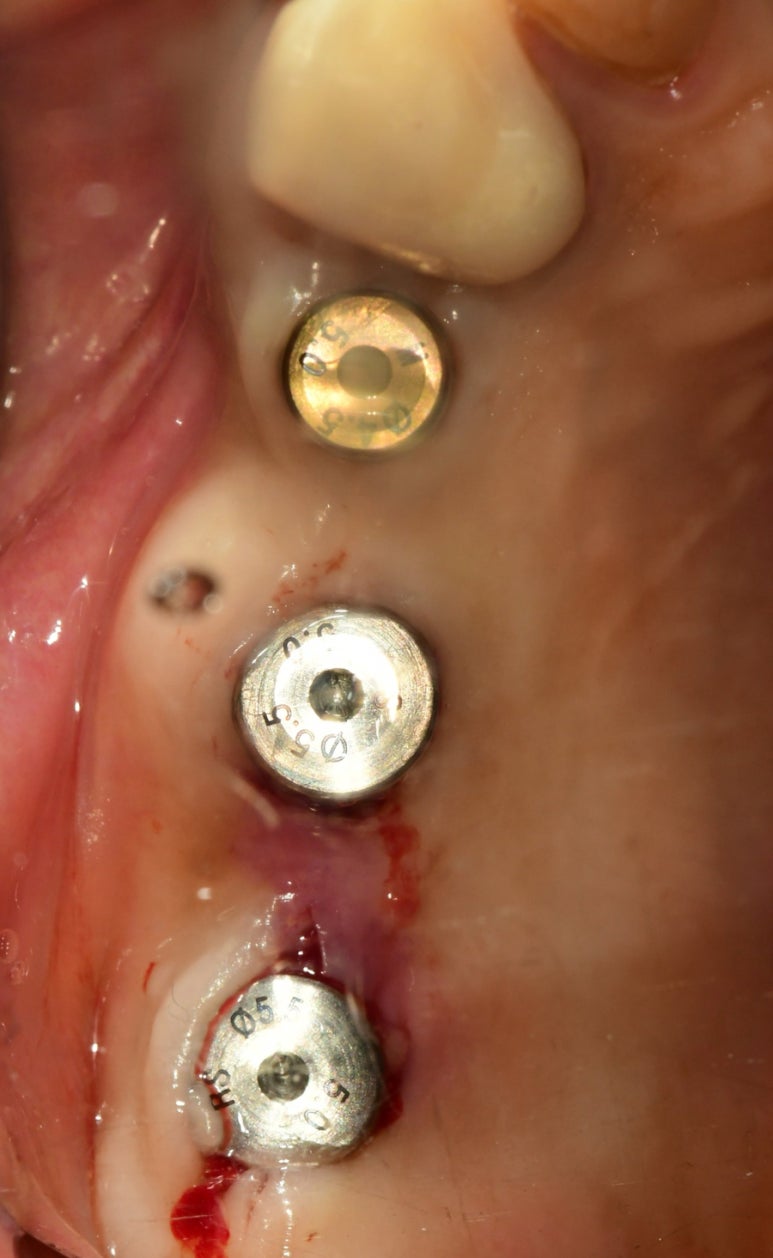 1ef72b757cecd.jpg