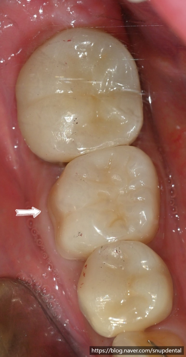 288ada2a294cf.jpg