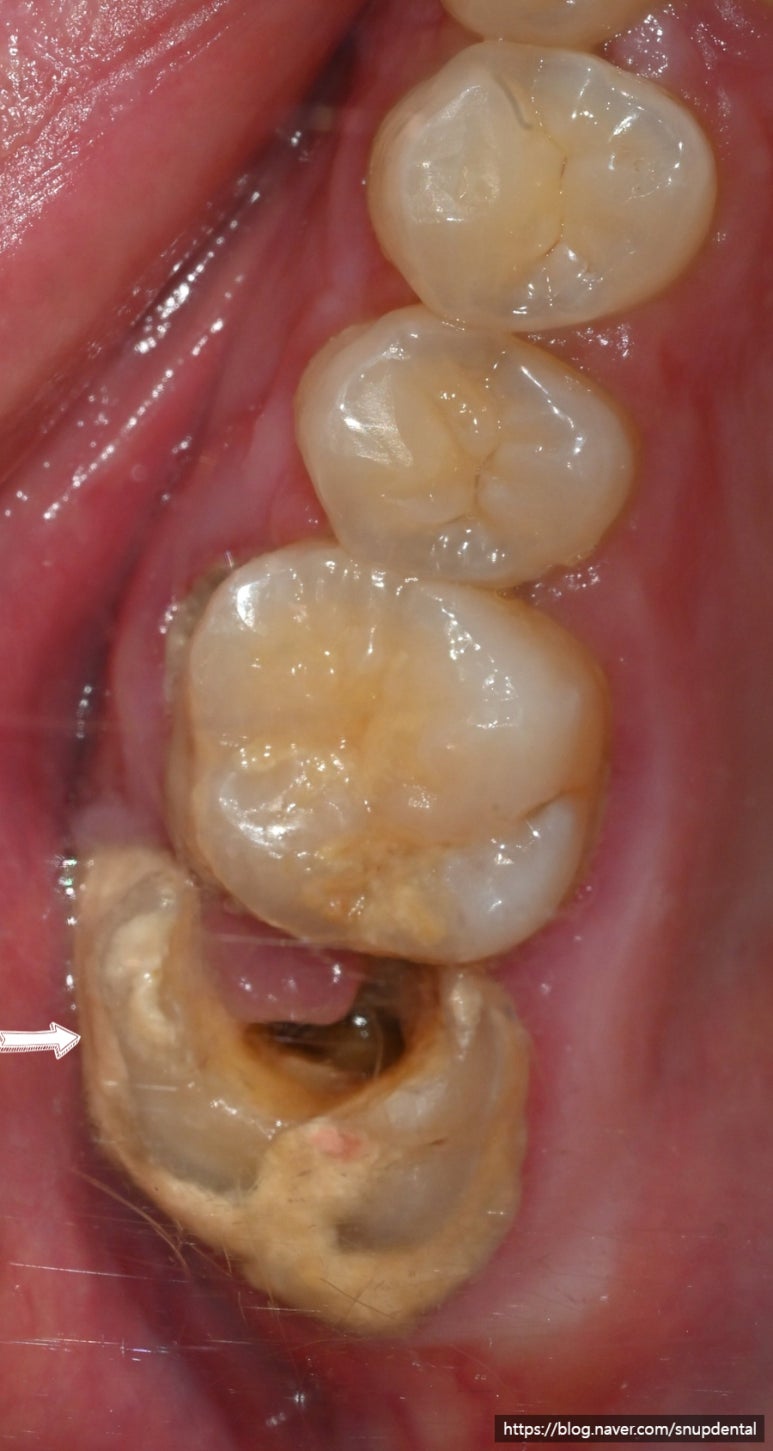 385ac1800cdf2.jpg