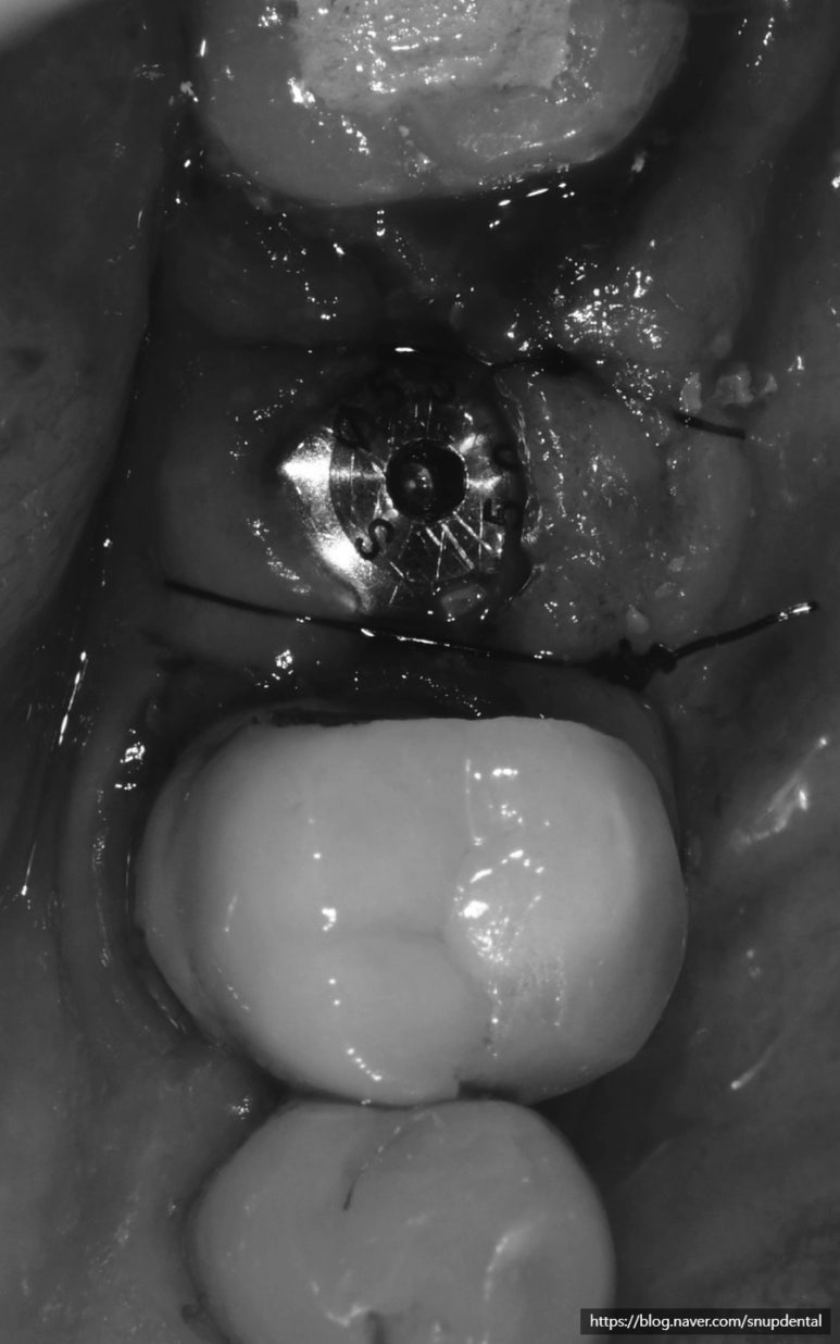 61b5905dd7fc4.jpg