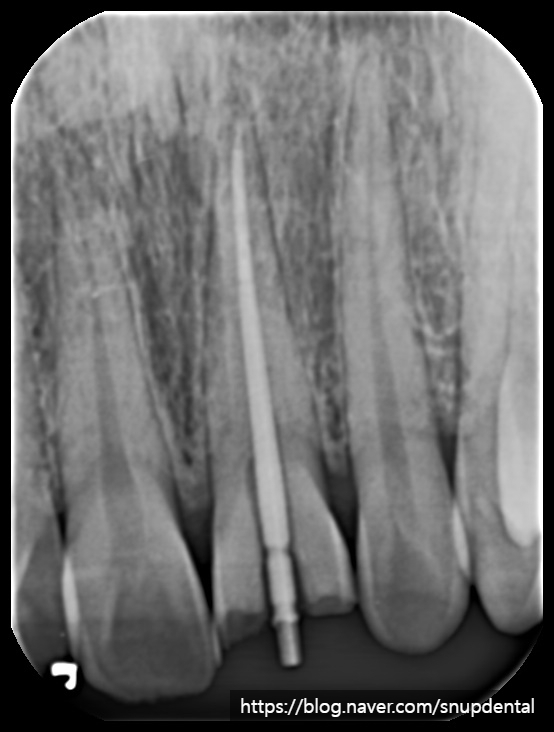 80ba0c96d48e1.jpg