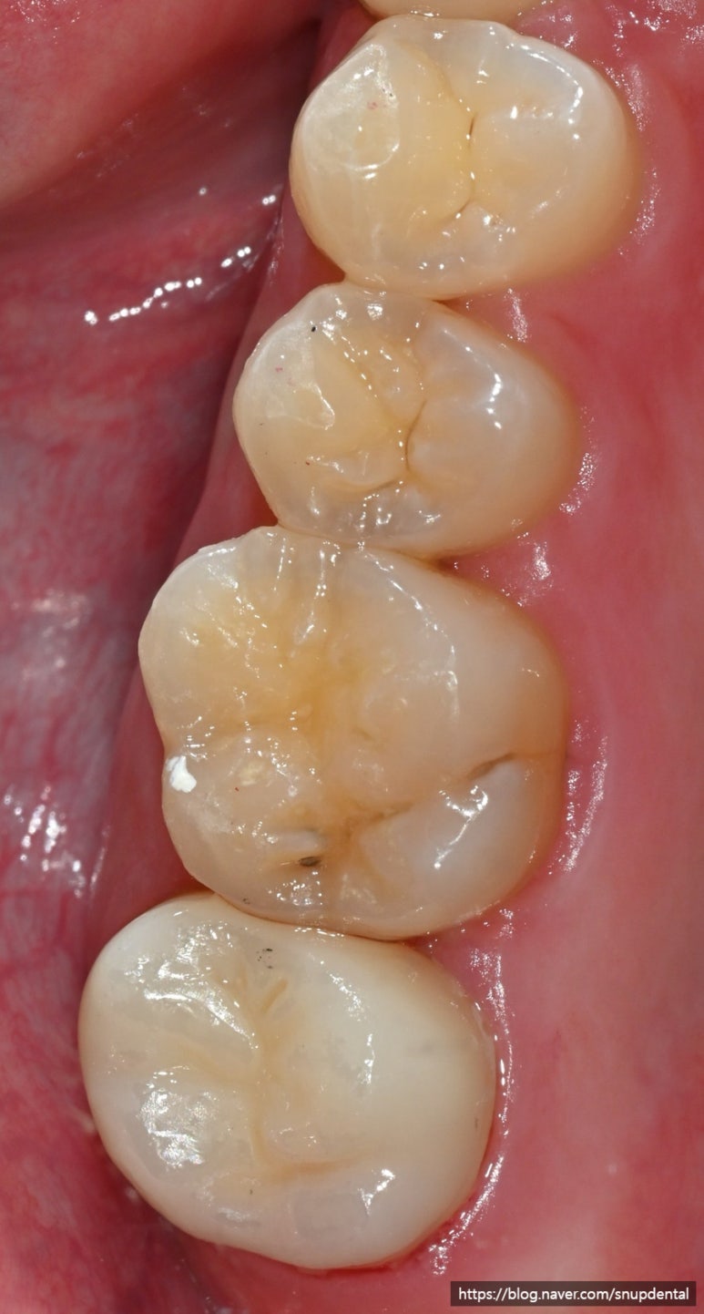 ea95d151d08f8.jpg