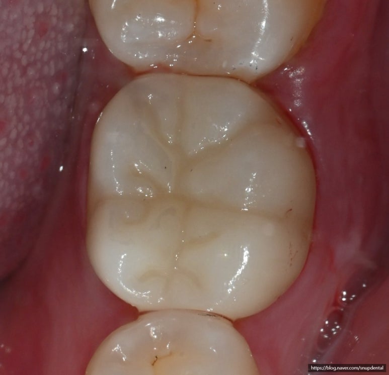 f256f7fb95ae0.jpg