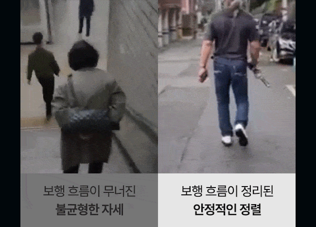 슈넥스 기능성신발 착용 전후 비포앤 애프터