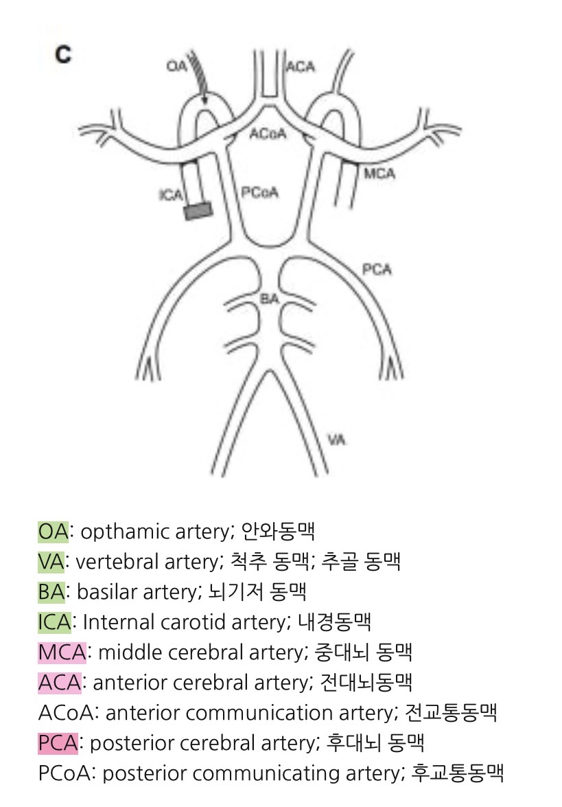 뇌혈류초음파 TCD 검사, 뇌졸중 예방의 첫걸음 : 삼성스마트신경과 서울점ㅣ박재현 원장