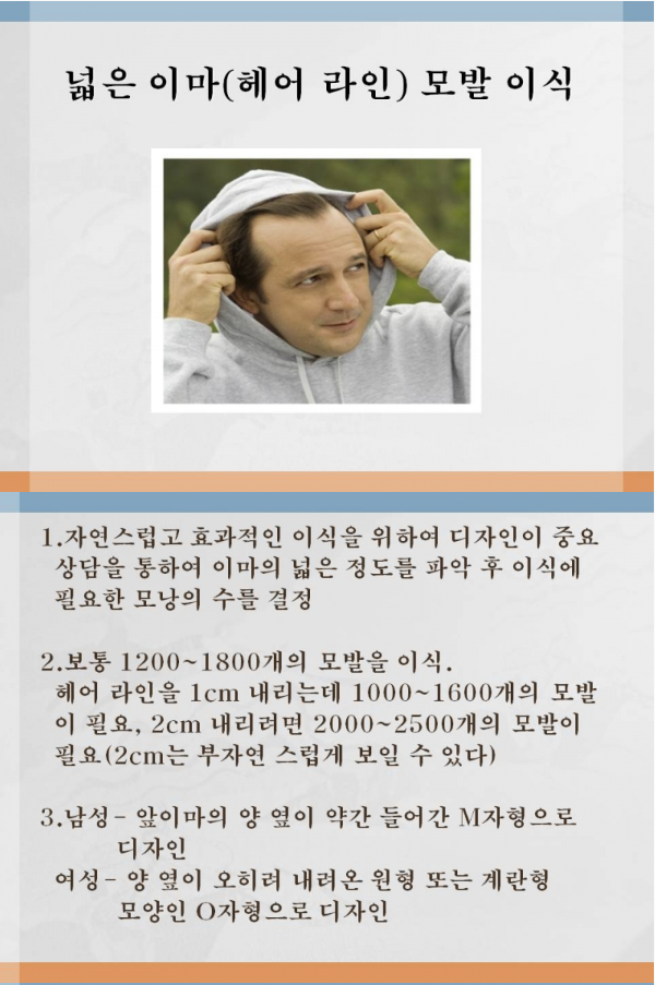 99362b3402136.png