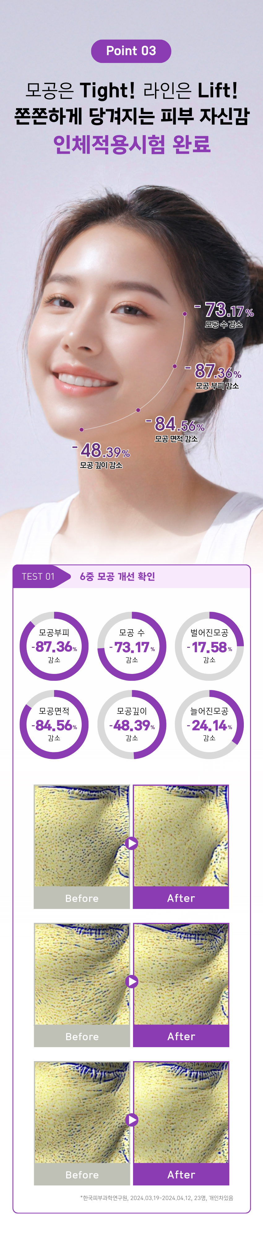 [06월 피부PT 루틴] 02 시카·티트리 앰플 50ml + 06 콜라겐 모공 타이트닝 앰플 50ml(+토너패드 + 세라마이드크림 본품 증정)