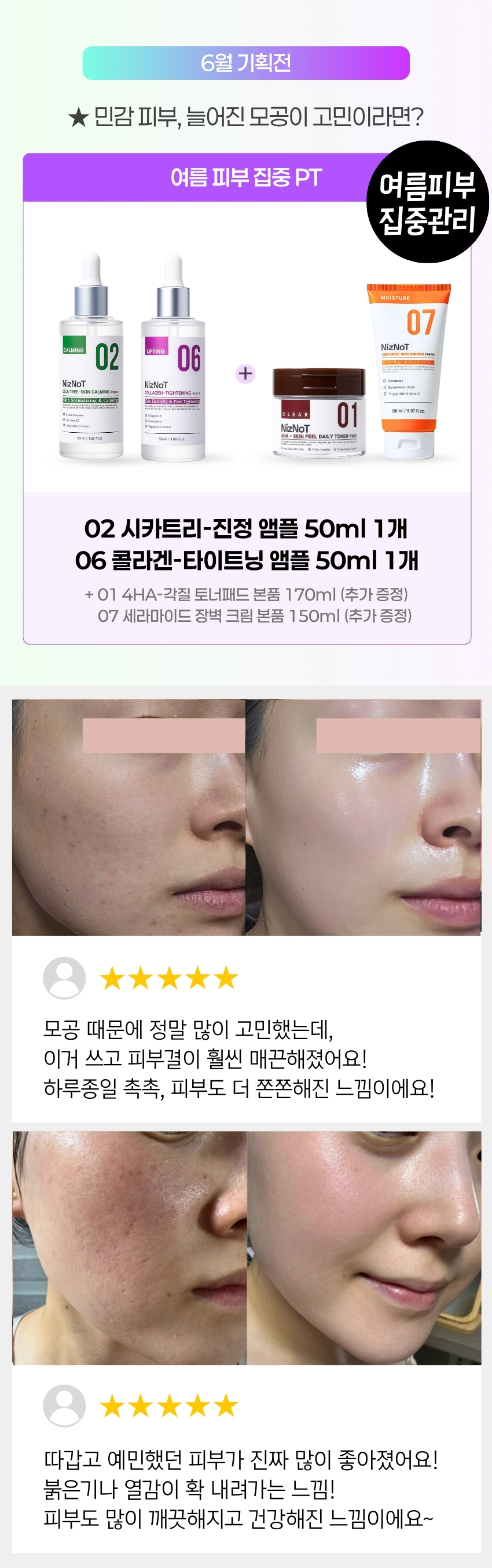 [06월 피부PT 루틴] 02 시카·티트리 앰플 50ml + 06 콜라겐 모공 타이트닝 앰플 50ml(+토너패드 + 세라마이드크림 본품 증정)