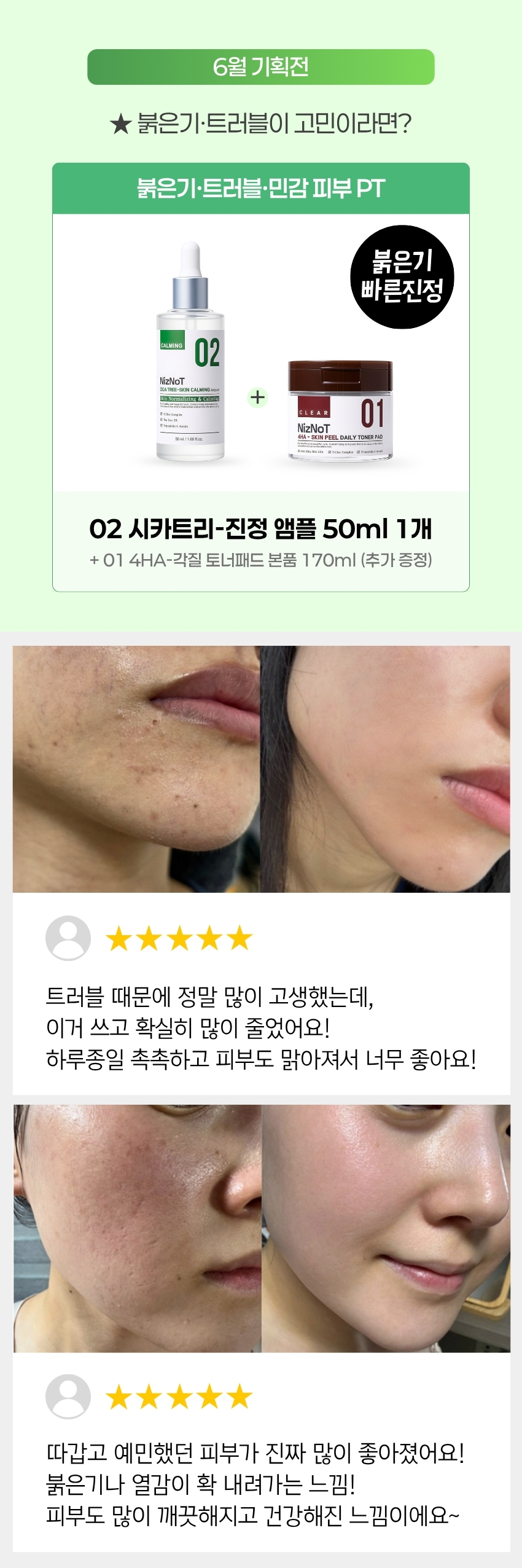 [06월 피부PT 루틴] 02 시카·티트리 앰플 50ml (+토너패드 본품 증정)