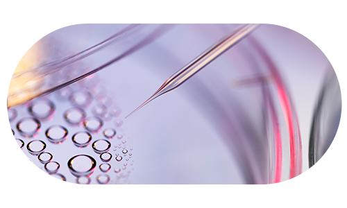 줄기세포 지방이식 시술 예시