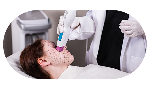 써마지 리프팅을 받는 여성