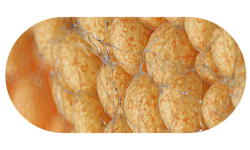 더미인의원만의 특허 시술 VPL