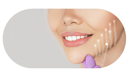 실리프팅 삽입 예시