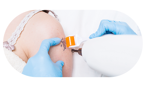 흉터를 치료 중인 모습