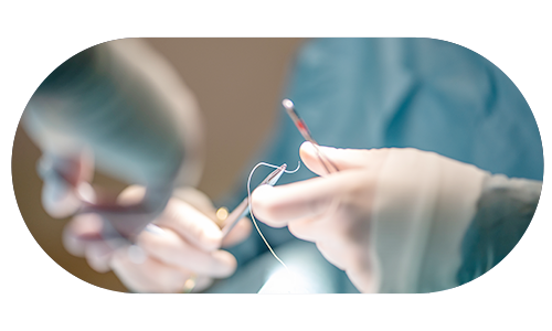 실리프팅을 준비하는 의료진