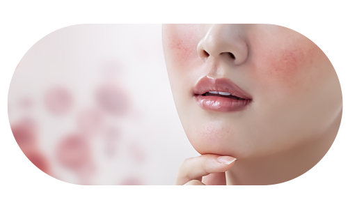 얼굴에 홍조를 띈 여성의 이미지