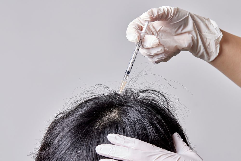두피 주사