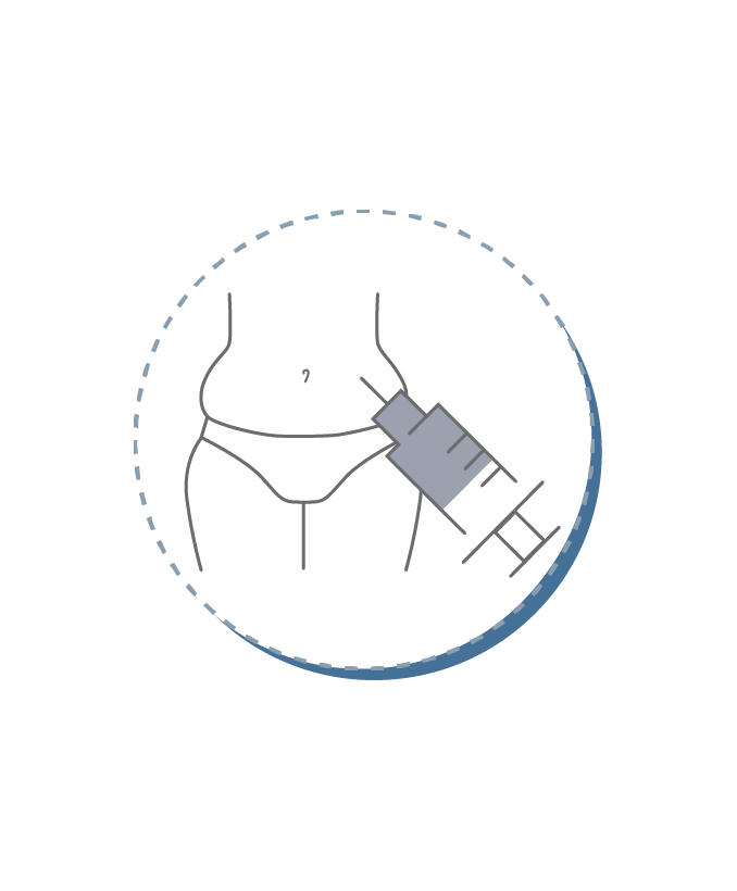 지방줄기세포 치료 이미지