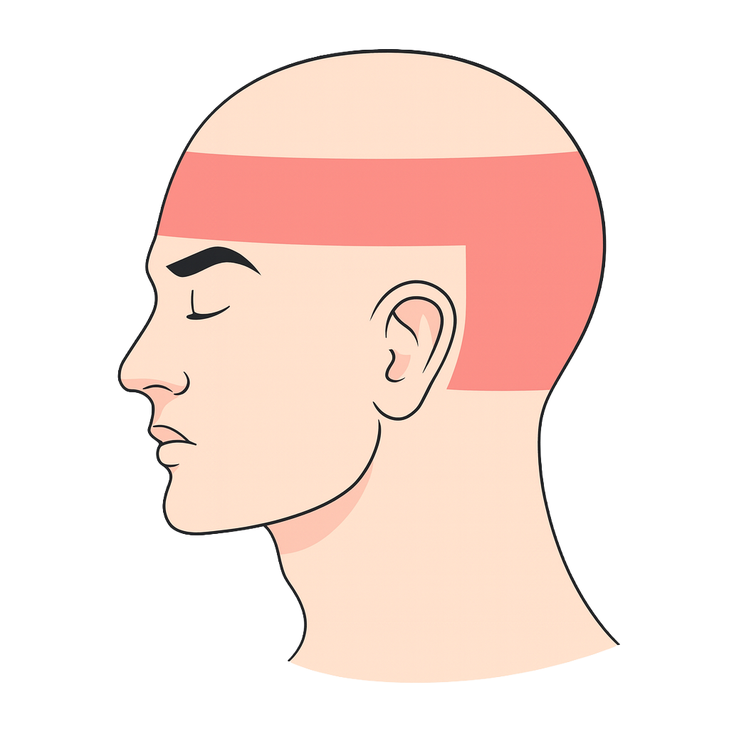 긴장성 두통 - 이마 근육 경직