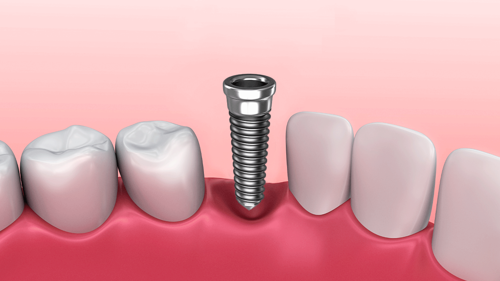 닥터조치과_4차, image size:1920x1080