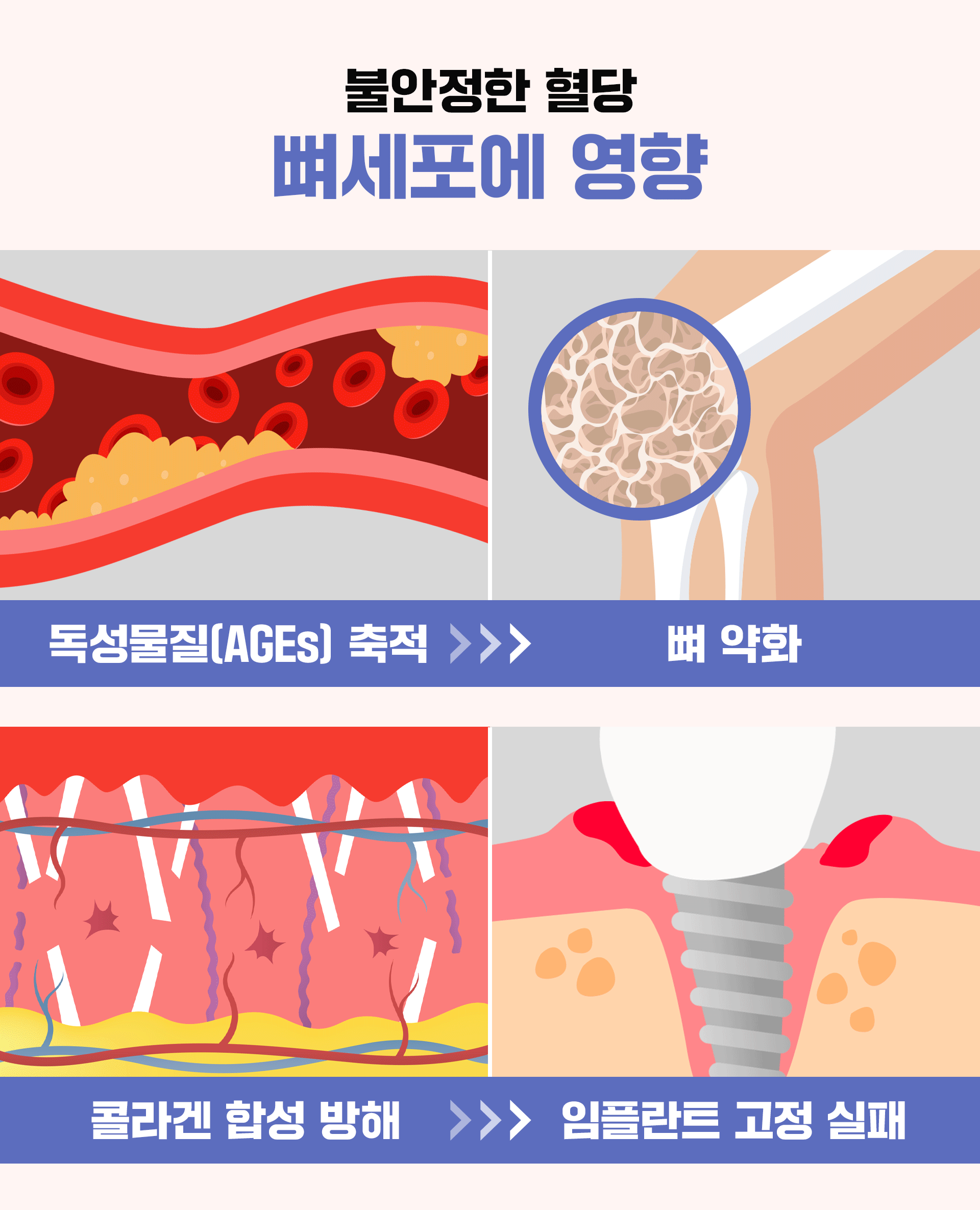 남성 윤곽수술은 3D CT를 활용하여 얼굴 골격의 비대칭 원인을 정밀하게 파악하고, 맞춤형 계획을 세울 때 가장 만족스러운 결과를 얻을  수 있습니다. 본 케이스는 사각턱 비대칭이 안면비대칭의 주원인임을 CT 분석으로 확인하고, 윤곽 3종, image size:1920x2371
