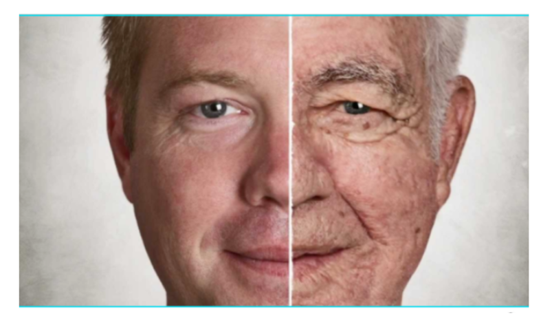 Botox