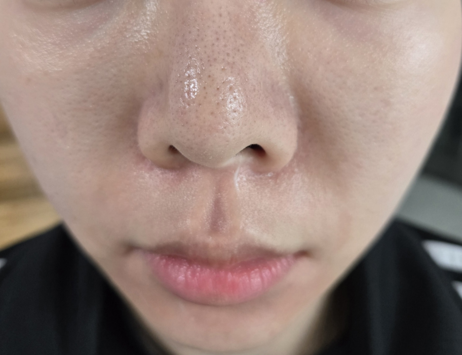 28029adf6991c.png