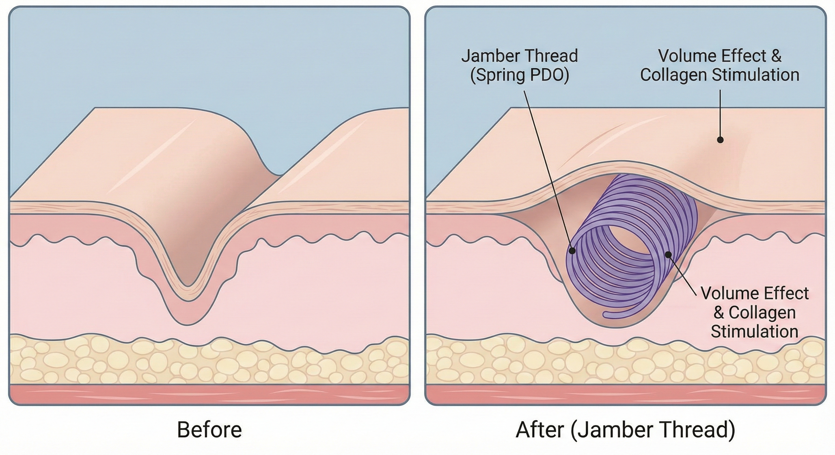 Jamber Threads