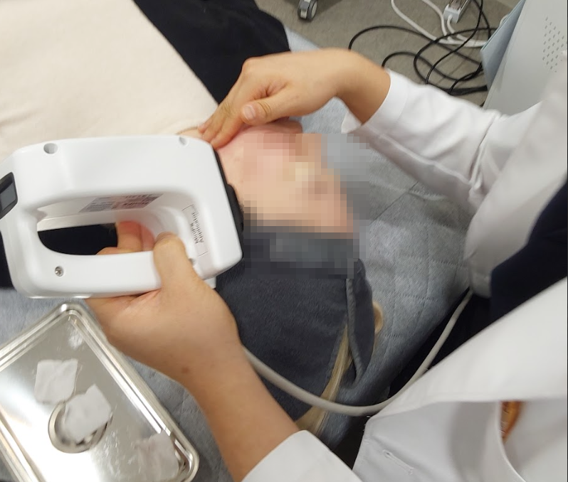인모드 시술