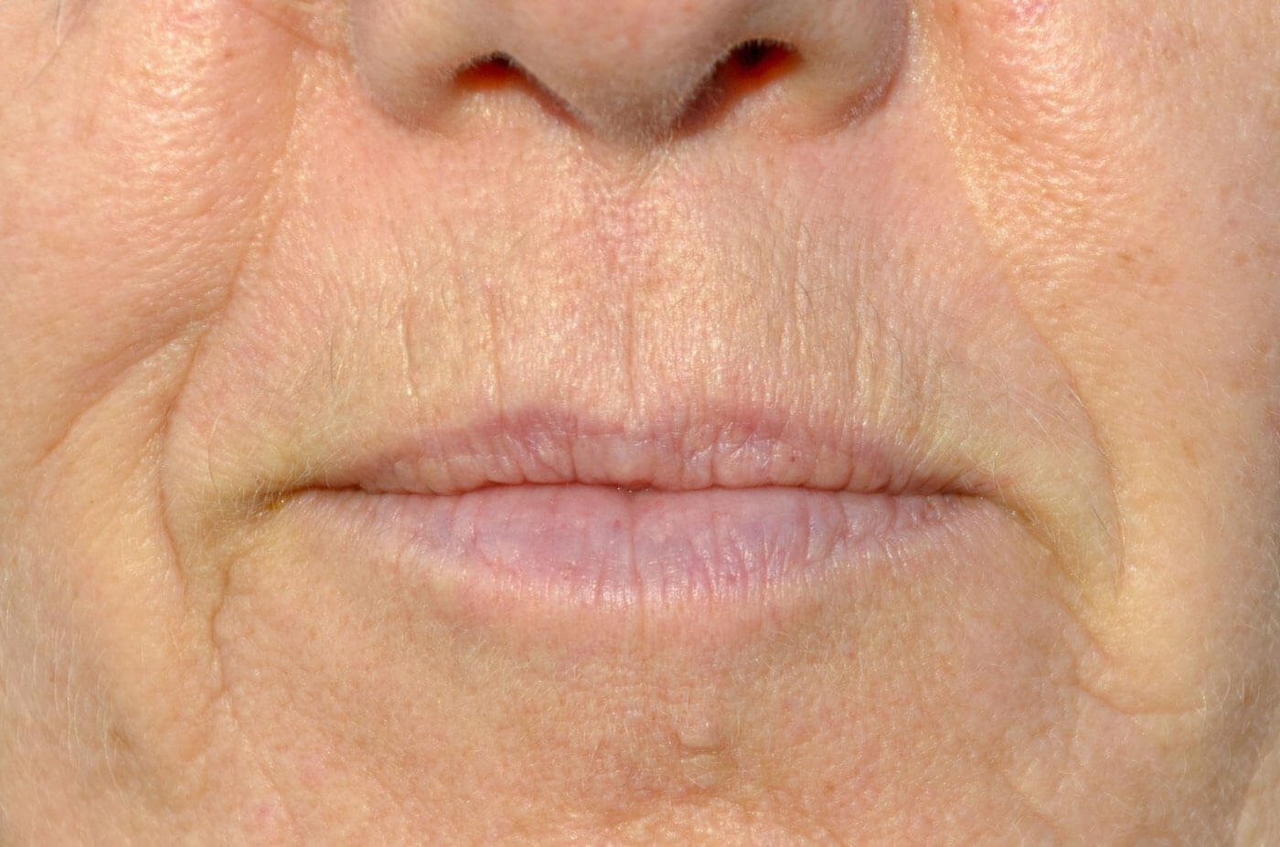 7fd9cb4a68578.jpg
